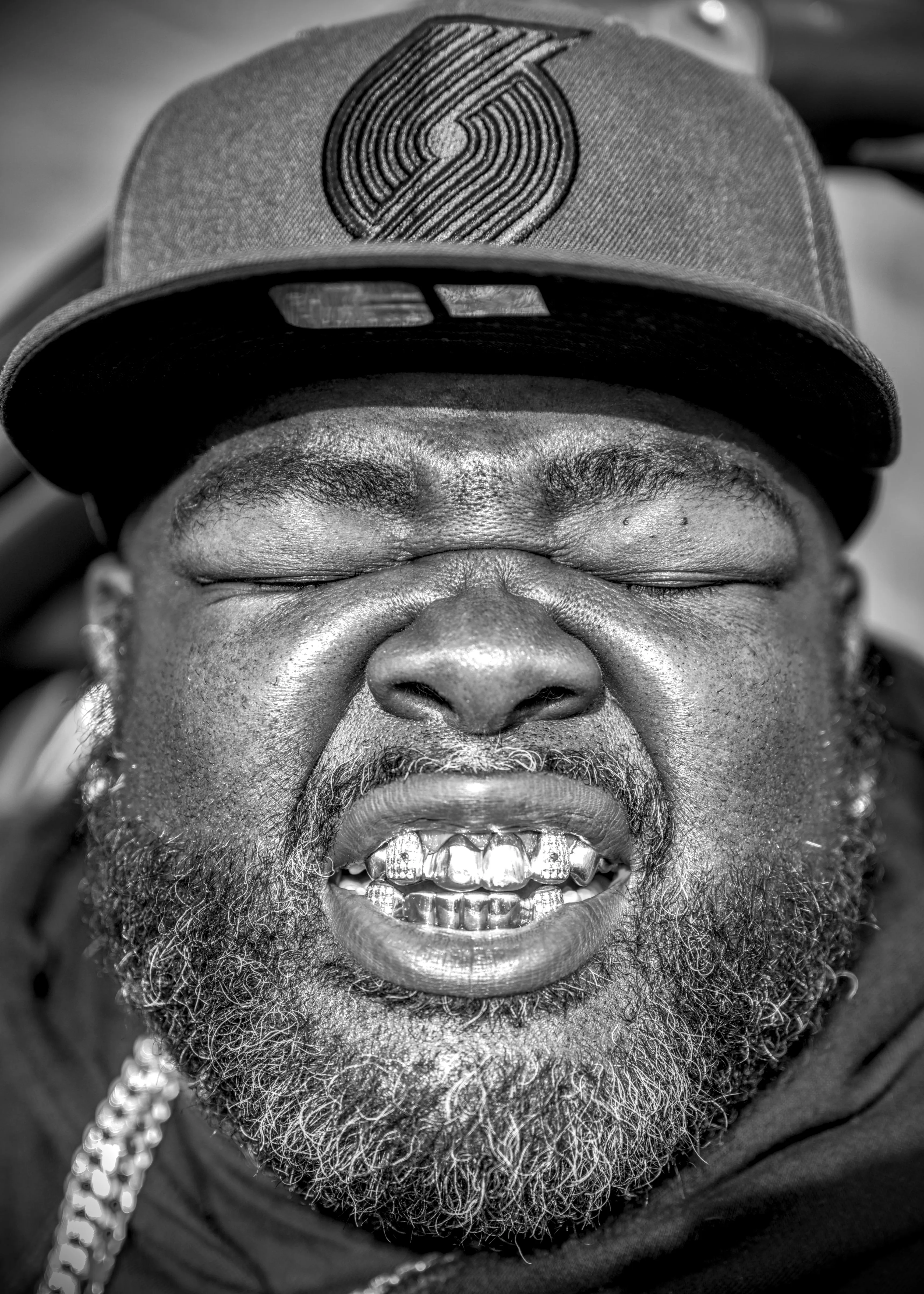 Close-up of a bearded man in a logo cap, eyes shut, grinning to show metal-covered teeth.